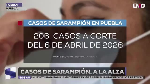 Se registra aumento de casos de Sarampión en Puebla