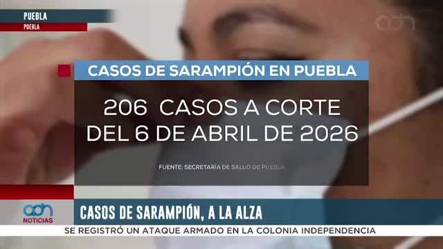 Sarampión en Puebla 2026: suman 206 casos y emiten recomendaciones de prevención