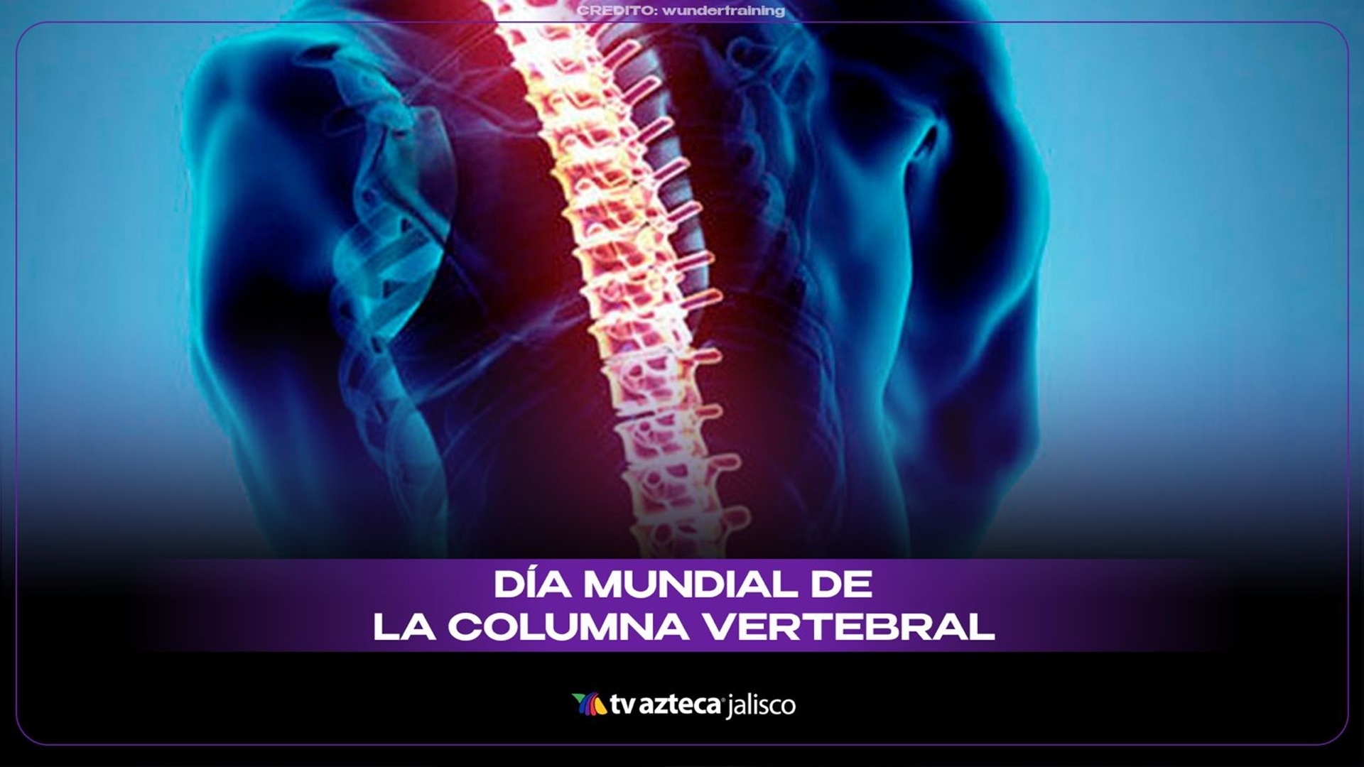 Columna vertebral: por qué cuidarla y tips de salud en el Día Mundial ...