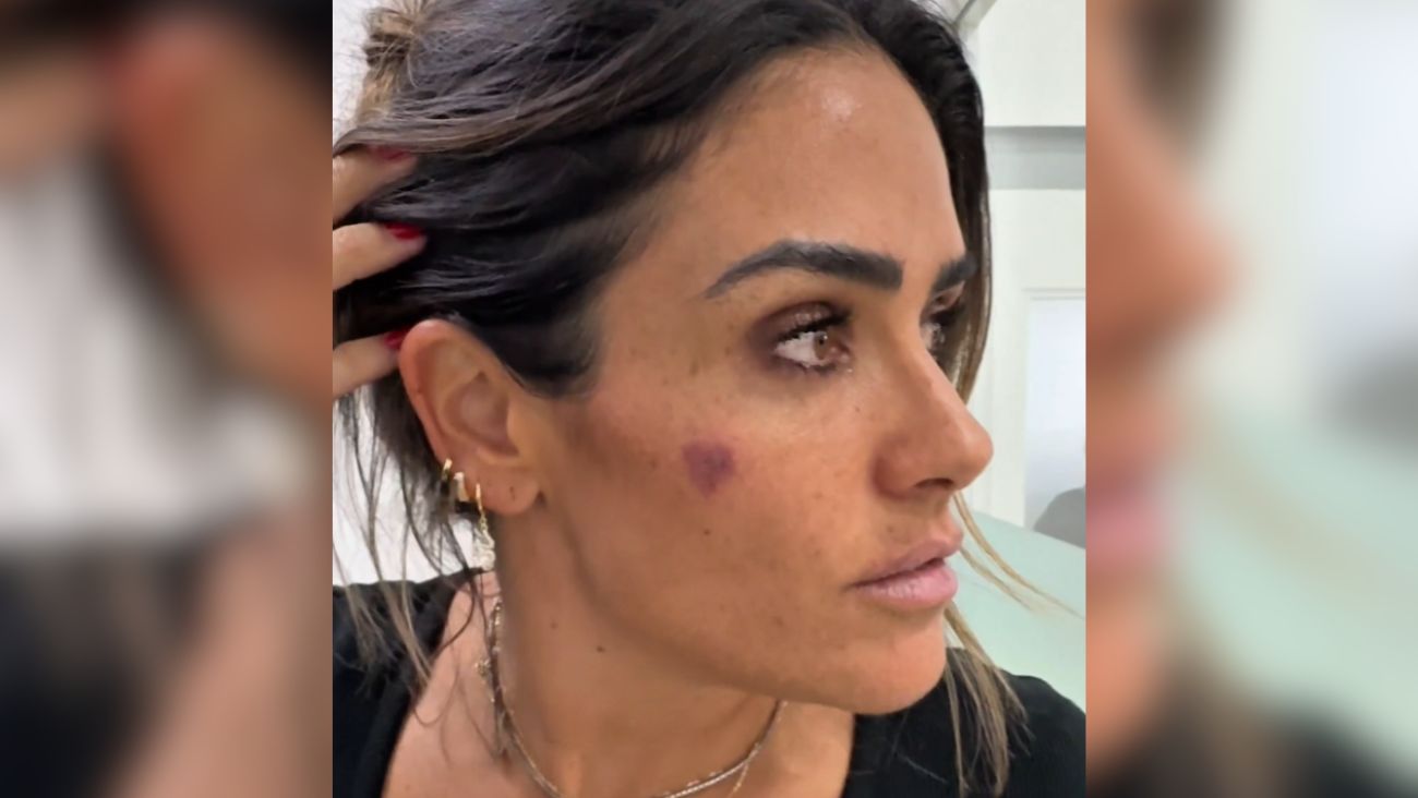 Alessandra Rojo de la Vega, alcaldesa de la Cuauhtémoc es agredida a golpes durante recuperación de espacios públicos