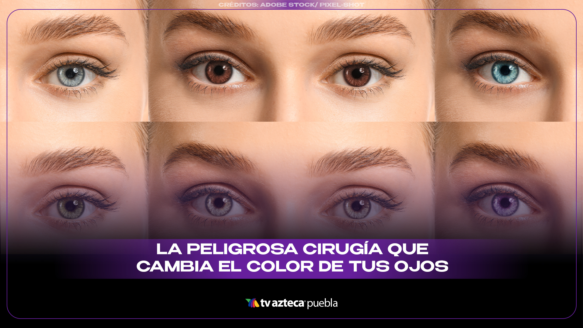 Qué es la queratopigmentación, la cirugía para cambiar el color de ojos