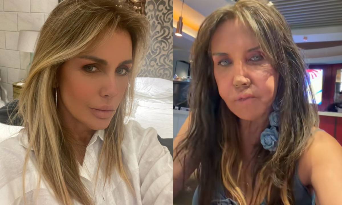 Qué le pasó a Sabine Moussier en la cara? Filtran VIDEO que alarma a sus  fans