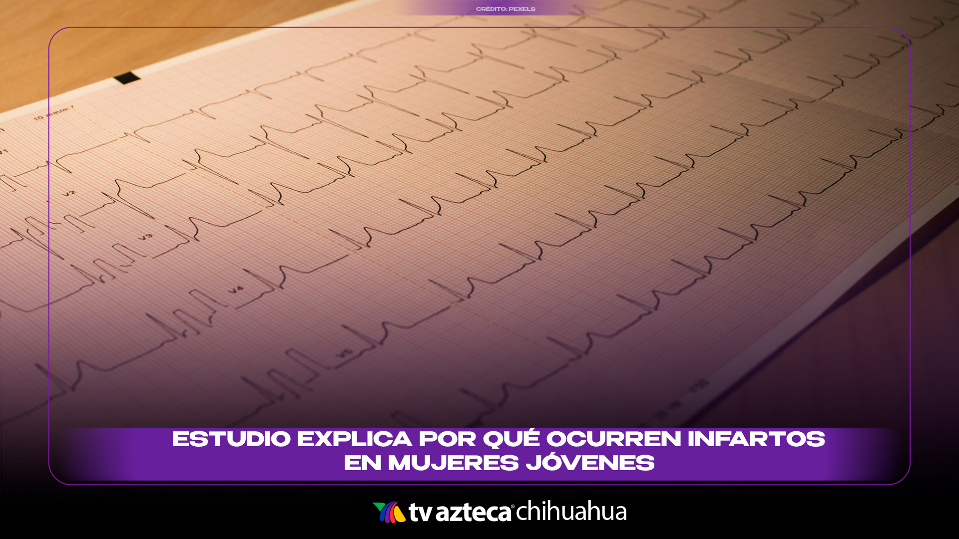 Estudio explica por qué ocurren infartos en las mujeres menores de 65 años