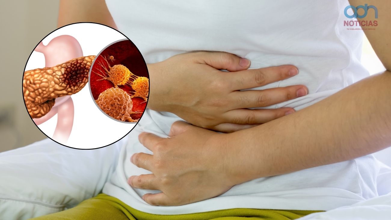 ¡Alerta! Los síntomas que parecen gastritis pero podrían ser un cáncer agresivo y mortal