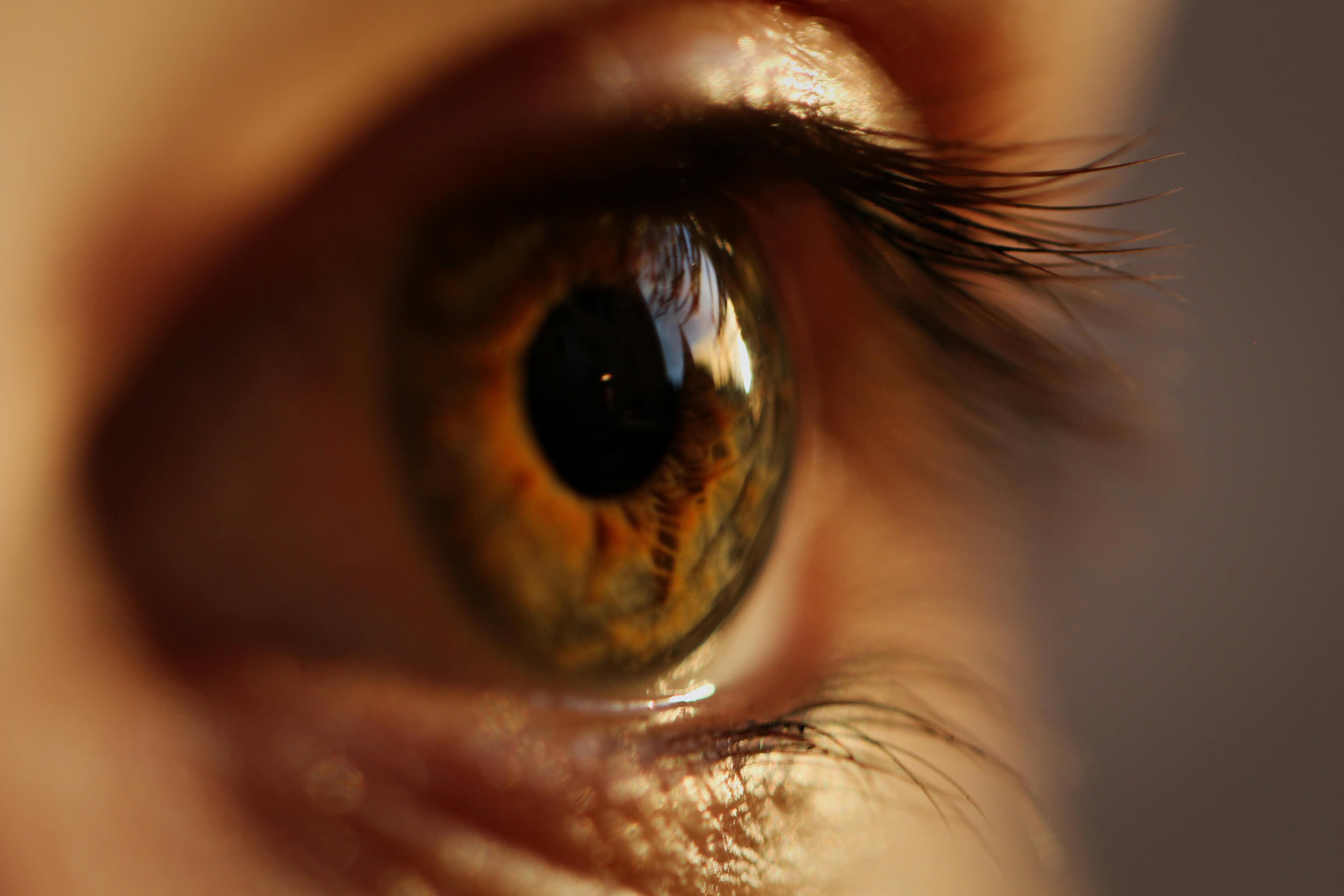 ¿Qué pasó con la mujer que aplicó Kola Loka en su ojo en Saltillo?
