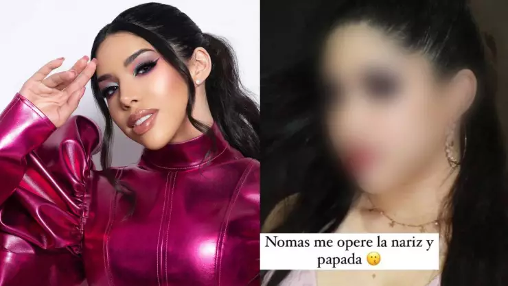 asi se veia yeri mua sin cirugias