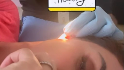 anahi-story-instagram-lesion-oido