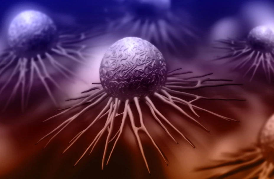 Cáncer cérvix