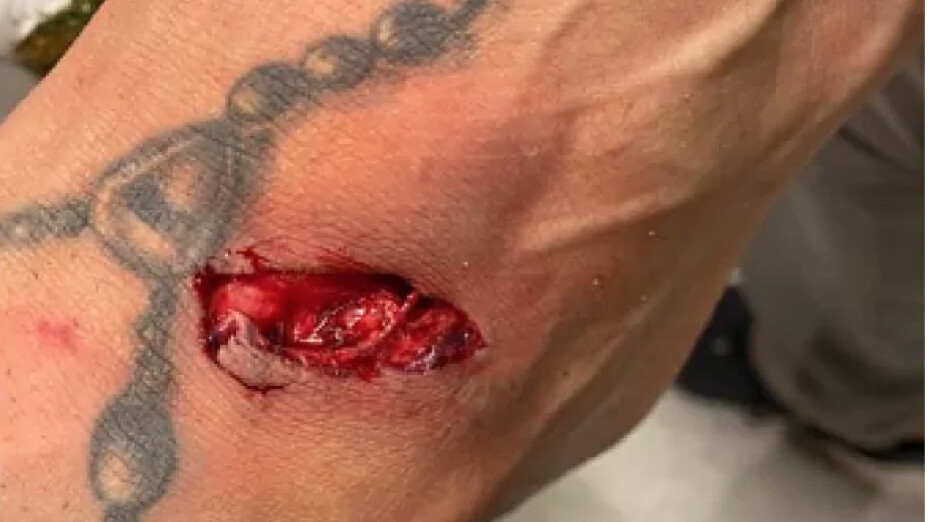 Pie de Alan Pulido