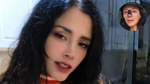 El mensaje de alivio de Dorismar tras iniciar proceso de recuperación de su nariz.jpg