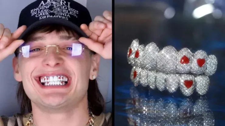 Peso pluma estrena dentadura de diamantes cuánto cuesta