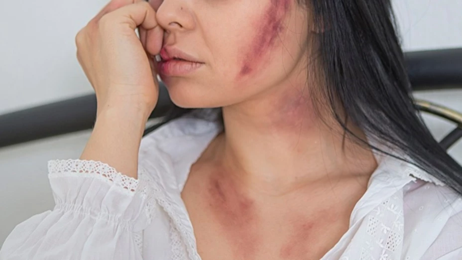 mujer es asesinada a golpes san andrés cholula