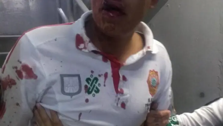 policía agredido.jpg