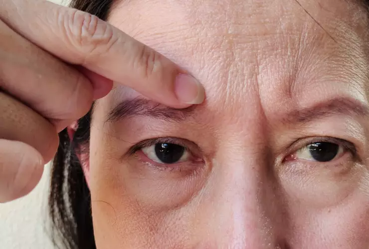 Sérum casero con colágeno para eliminar las arrugas a los 50 años