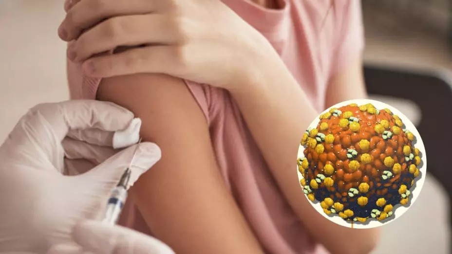 Vacunación contra el sarampión 2025.