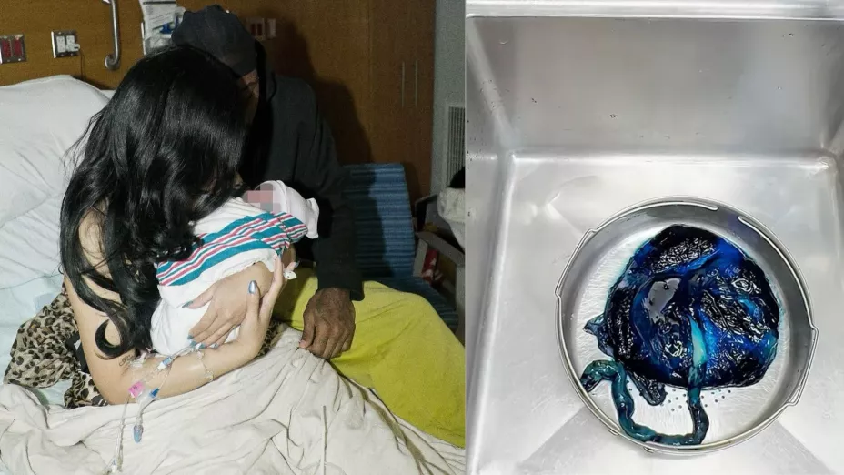 Cardi B y Stefon Diggs con su bebé  recien nacido y cordón umbilical  