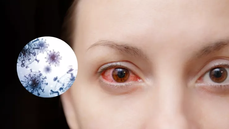 Aumentan casos de ceguera por nodavirus de mortalidad encubierta