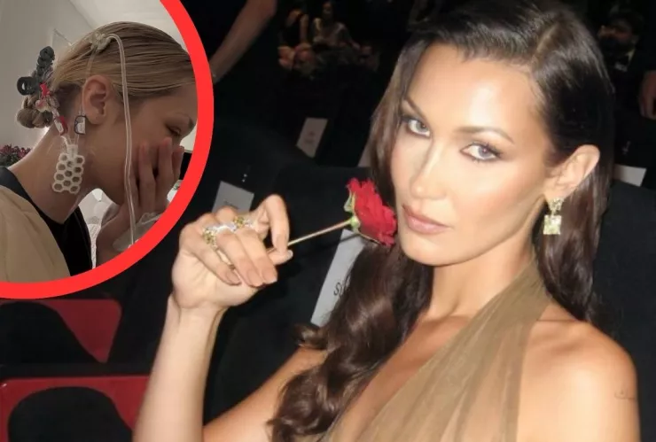 Enfermedad de Lyme: el diagnóstico que enfrenta la supermodelo Bella Hadid