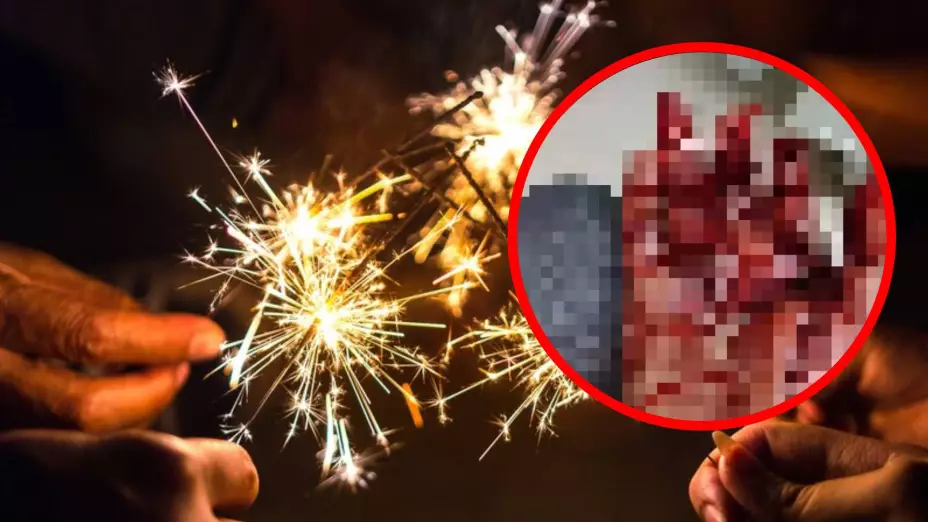 Persona resultó gravemente herida por utilizar pirotecnia explosiva en Chetumal.jpg