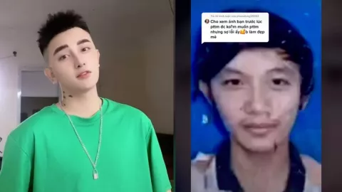 Rostro cirugías entrevista 2.jpg