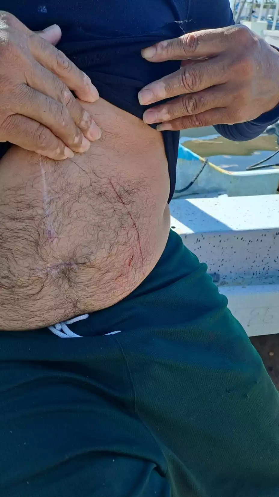 ATAQUE de lagarto contra pescador en Dzilam de bravo (FOTO)
