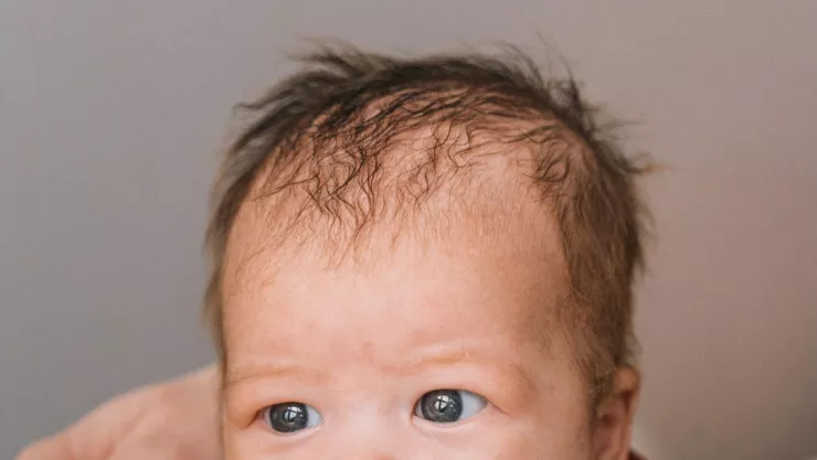 Error en medicamento en España dejó a 21 bebés con crecimiento de vello tras ingerir minoxidil