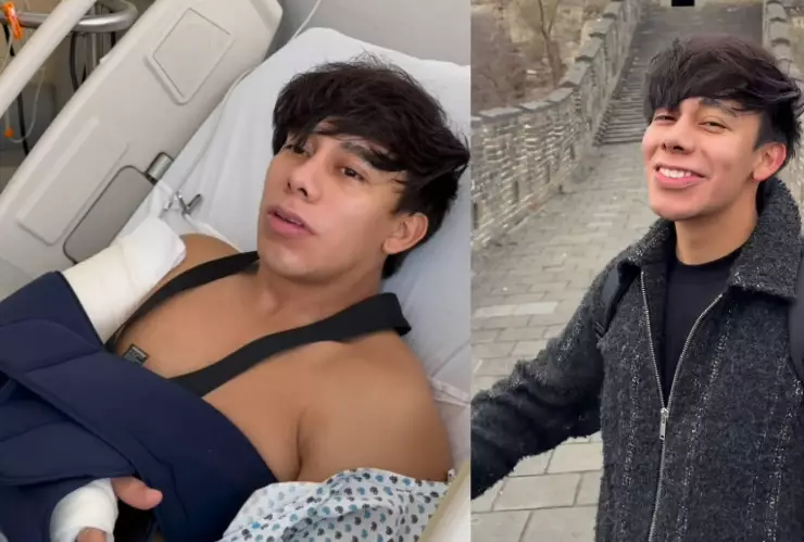 Sonrixs podría perder la movilidad de la mano tras sufrir una fractura múltiple.jpg