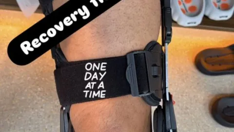rodilla.jpeg