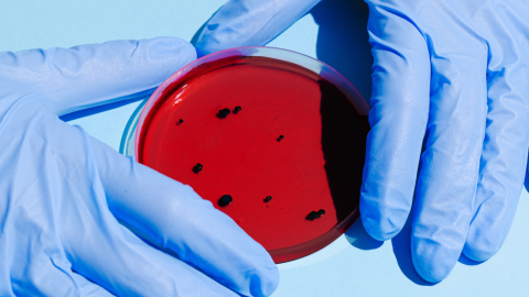 muerte celular proceso detener