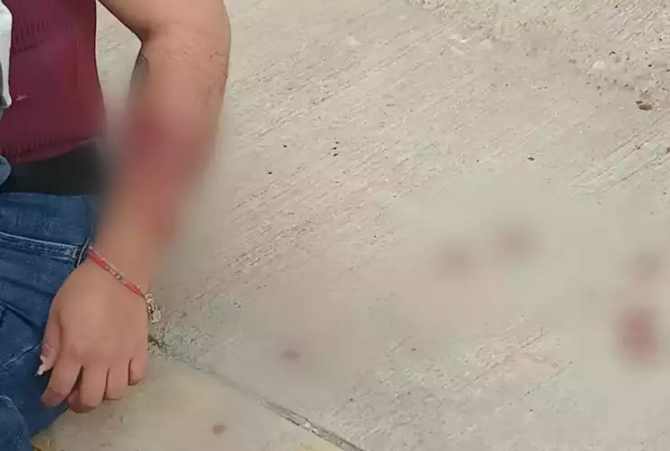 mujer atacada perros cuautlancingo