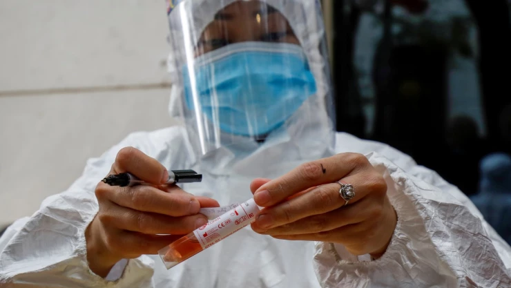 prueba_anticuerpos_covid_19