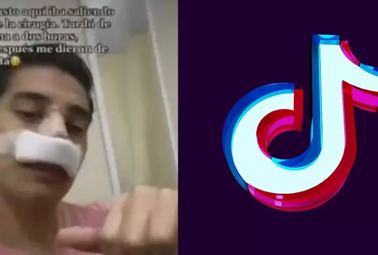 VIDEO Peligroso reto viral de TikTok que consiste en martillazos en la cara