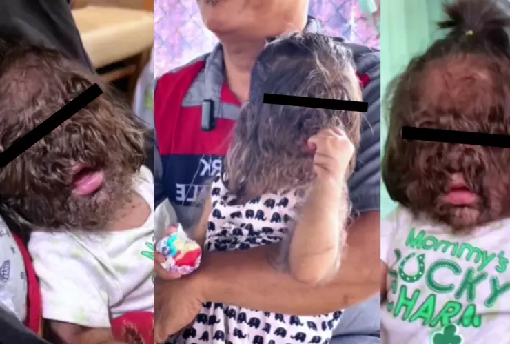 Niña lobo inquieta en redes sociales