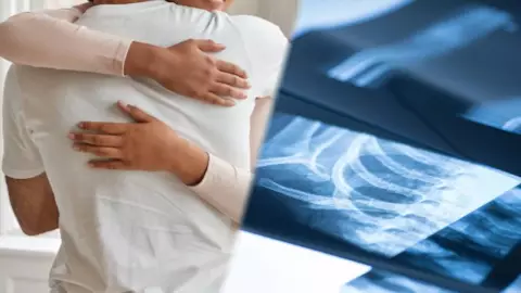 Le rompe los huesos de un abrazo.jpg