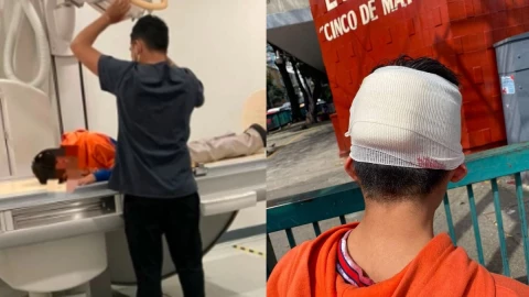 El menor fue agredido en el recreo.