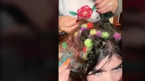 VIRAL_ Retiran bunchems del pelo de una joven; fueron más de 2 HORAS en quitarlos