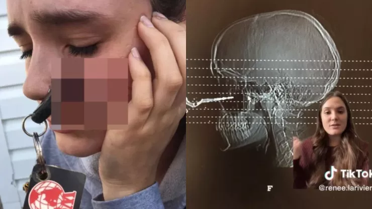 A punto de conducir y termina con la llave del auto clavada en su cara