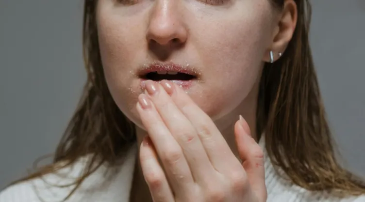 vaselina labios resecos.jpg