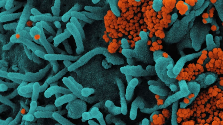 ¡Alerta en EU! Detectan bacteria “carnívora” en aguas costeras