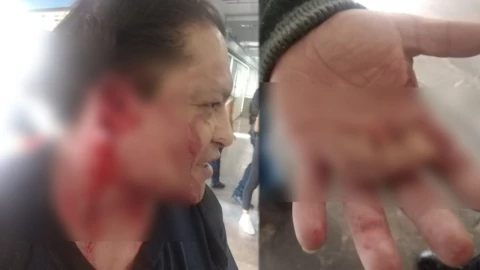 Arrancan oreja a sujeto en el metro.jpg