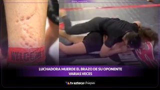 Así terminó el brazo de Ana Bozovic tras el ataque antideportivo de su oponente