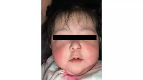 Guardería entrega a bebé fuertemente golpeada, en Mérida