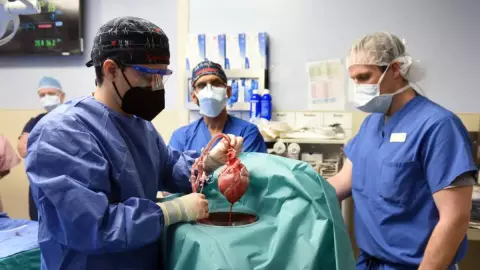 Muere el hombre que recibió trasplante de corazón de cerdo (2)