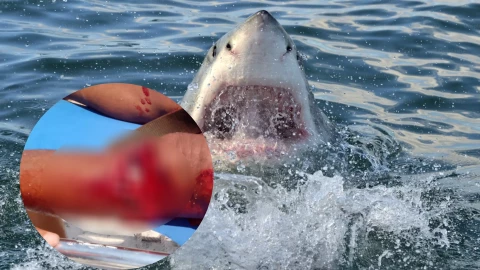 Ataque de tiburón en Banco Chinchorro deja a pescador herido