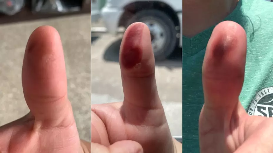 foto_dedo_voto