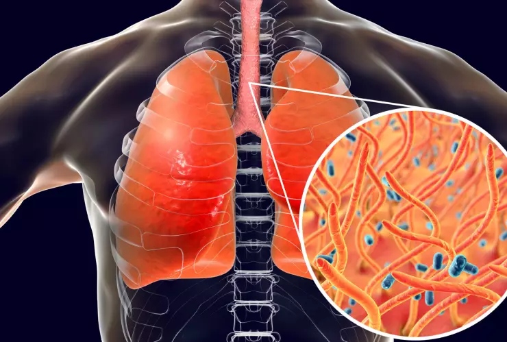 Suman 13 casos confirmados de tos feina en Morelos.
