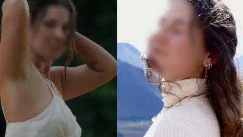 ¡Alarmante! Parásito infecta y devora el ojo de famosa INFLUENCER, la dejó CIEGA