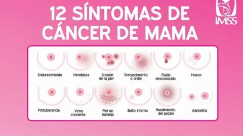 Síntomas para detectar el cáncer de mama