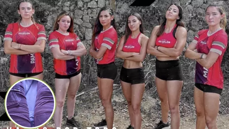 Así quedaron las piernas de esta leyenda de Exatlón México tras una operación