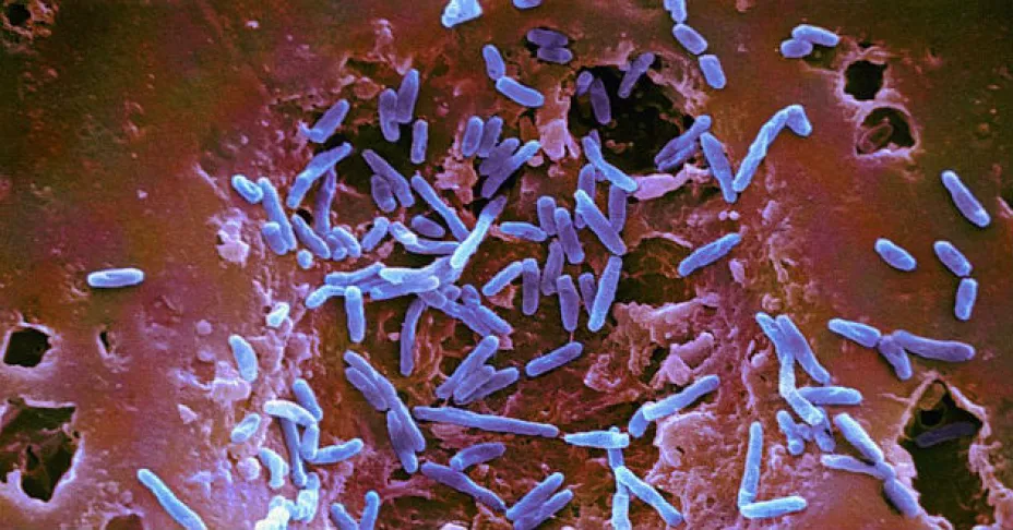 salmonella